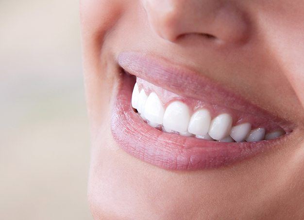 Closeup of smile with teeth whitening