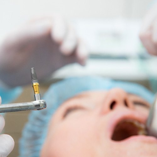 Closeup of gloved hand hold dental implant with patient blurry in background