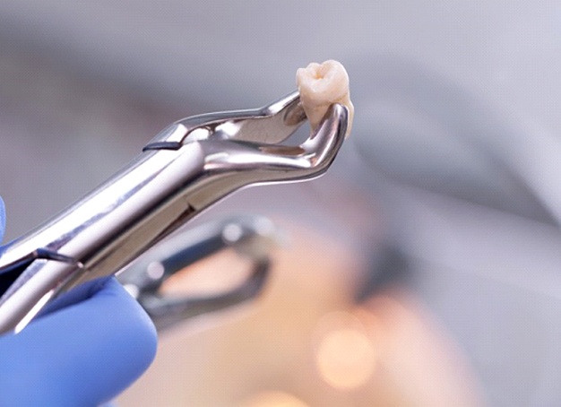 dentist in Parsippany holding an extracted tooth in a dental instrument