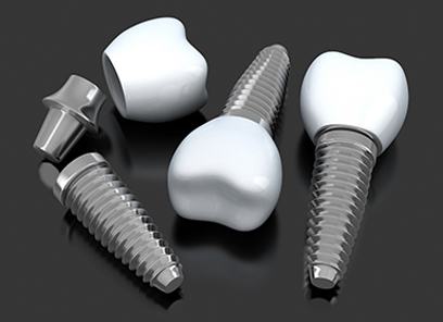 three dental implants lying on a table