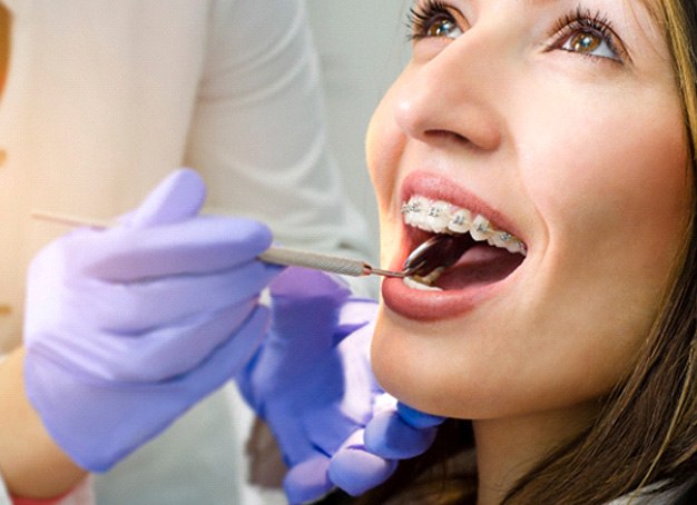 The cost of traditional braces in Parsippany