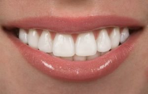 A closeup of someone’s white smile.