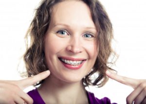 woman wearing braces