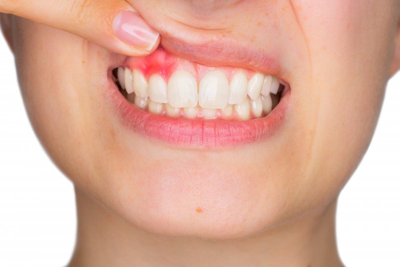 closeup of young woman with red gums