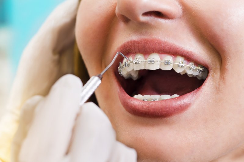 person with braces having them worked on by orthodontist