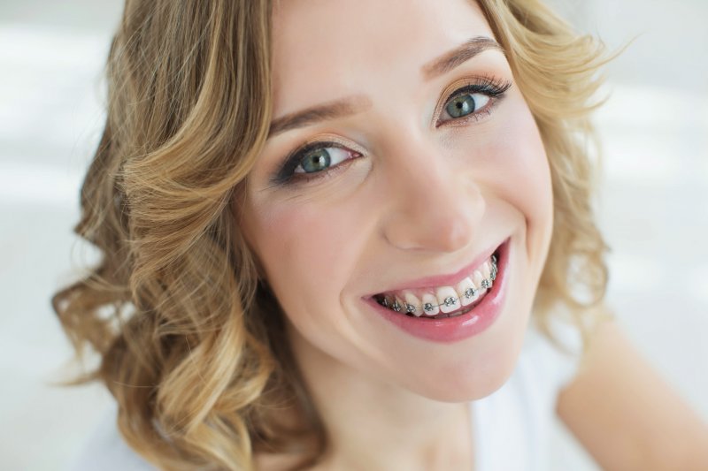 A woman wearing adult braces in Parsippany
