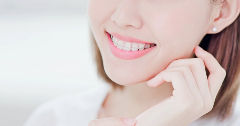 Young woman wearing a retainer