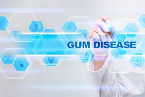 Digital screen showing gum disease