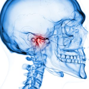 X-ray of a skull with the TMJ colored red