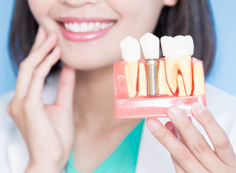 Dentist holding dental implant model