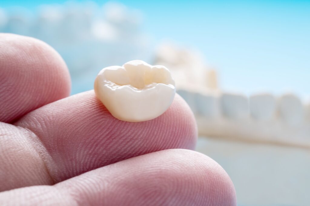 Dental crown on fingertip with model jaw in background